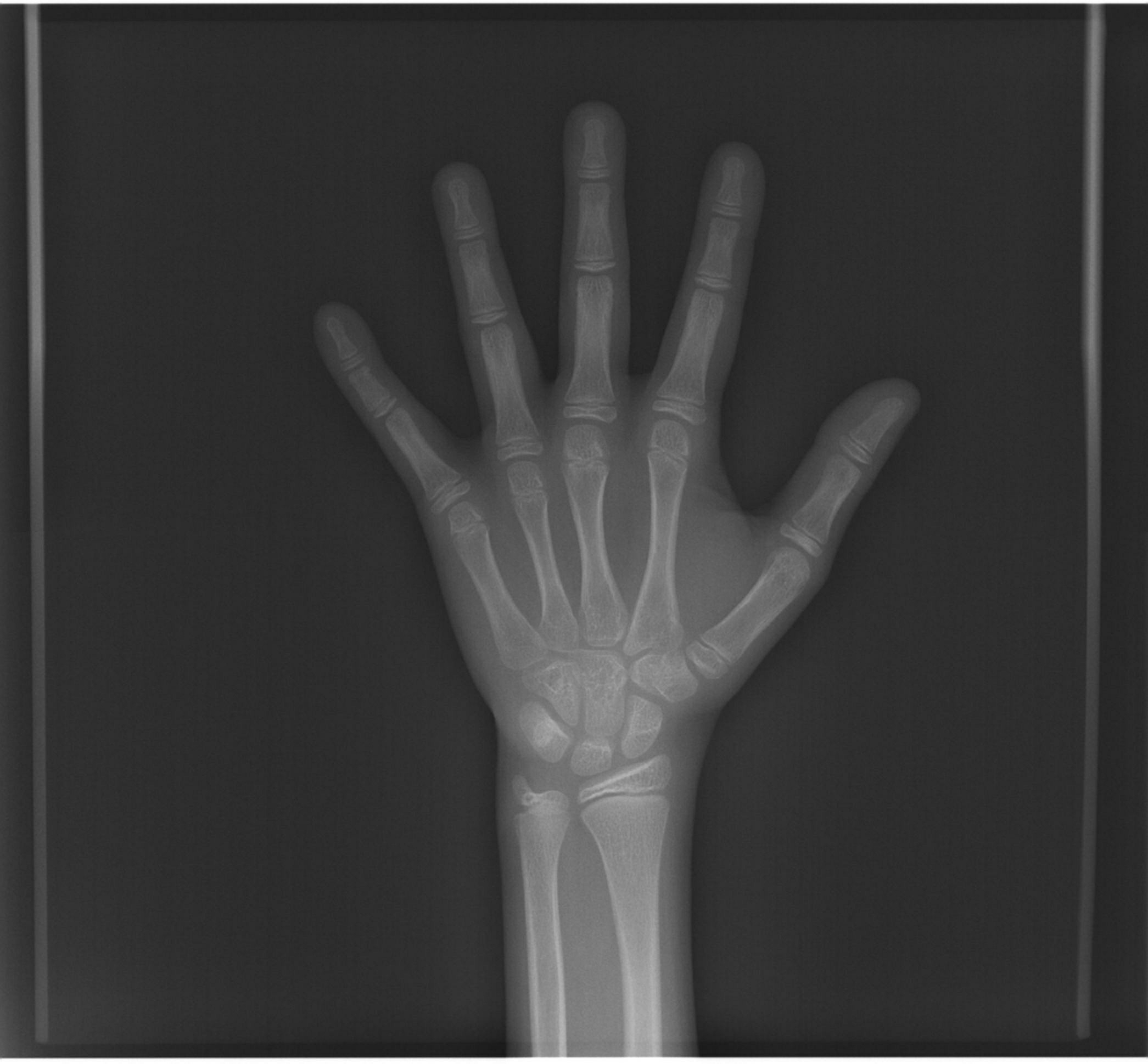 Radiografia de Mão e Punho